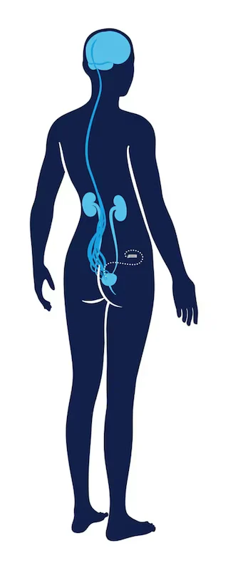 The urinary system connected with the InterStim X device